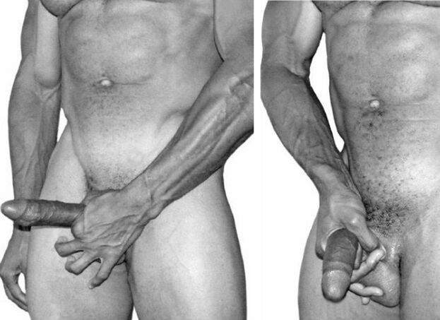 Jelching用于阴茎增大